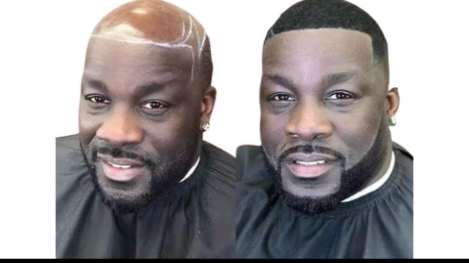 Men’s Hair Systems London: Non-Surgical Hair Replacement at Hector’s Global Hair with Zeal – image 3